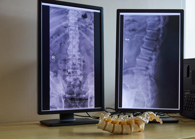 Lumbar spine model in medical office